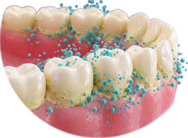 Зубы с налетом